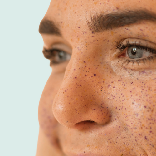 Uneven Skin