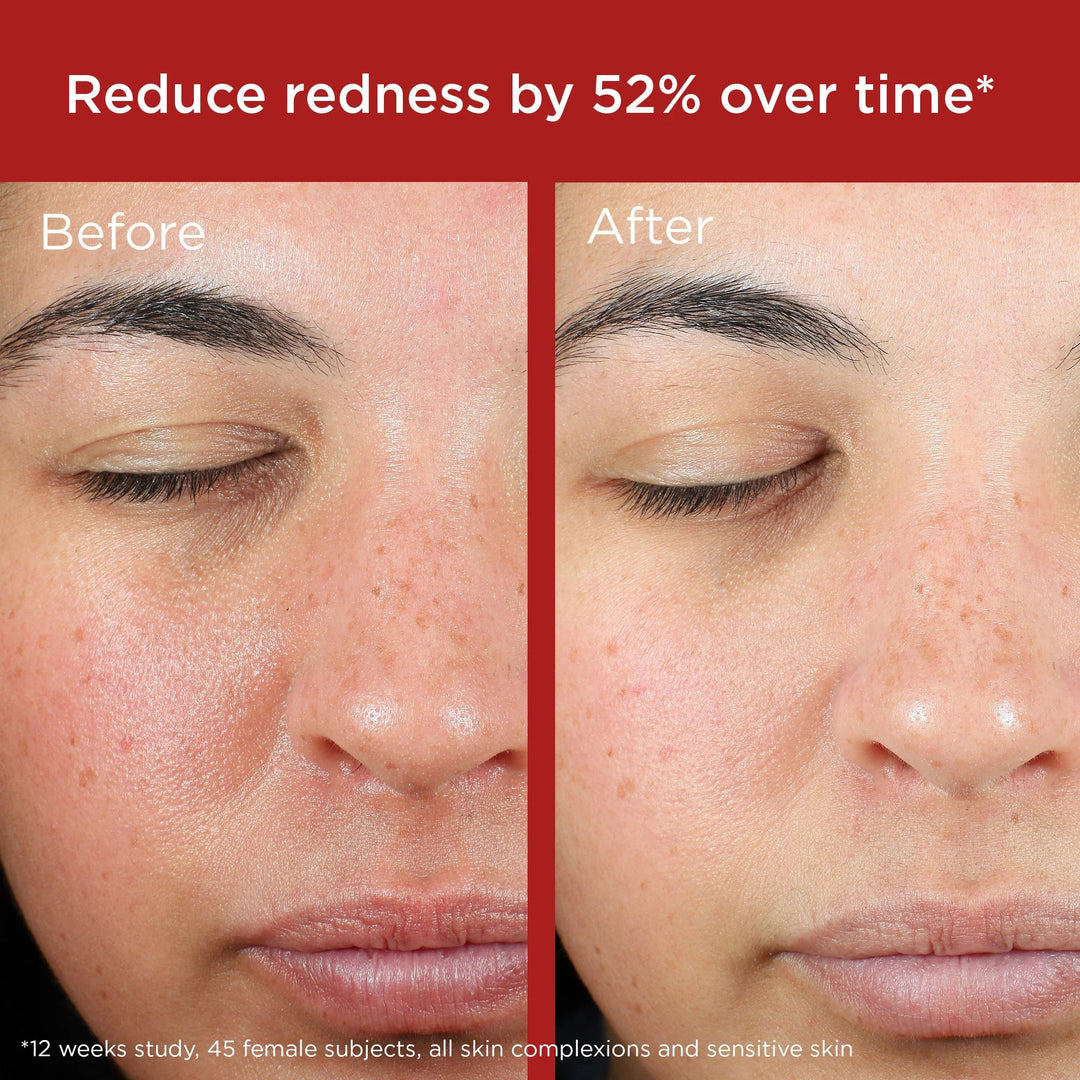 EltaMD - UV Skin Recovery Red Color Correcting Green Tint Broad Spectrum SPF 50