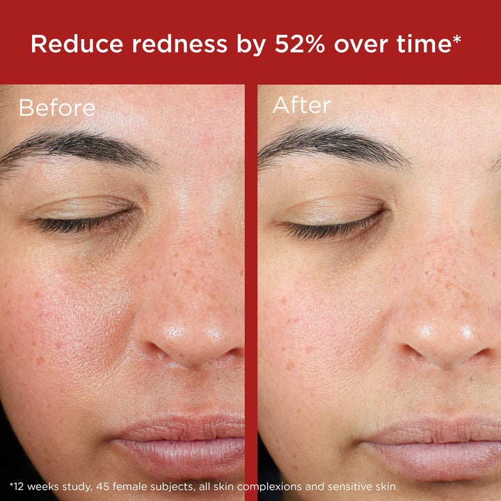 EltaMD - UV Skin Recovery Red Color Correcting Green Tint Broad Spectrum SPF 50
