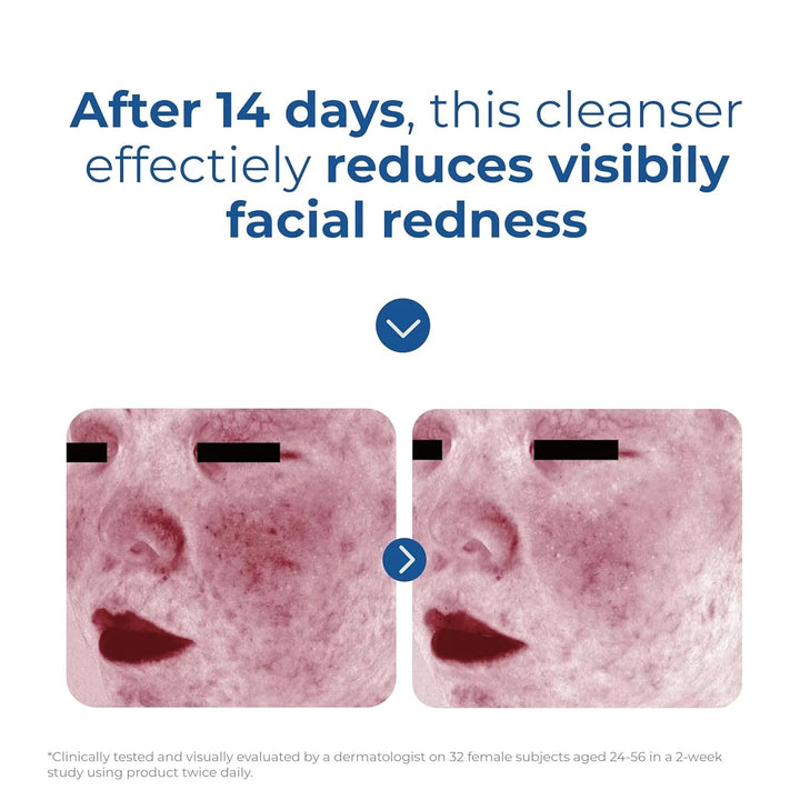 EltaMD - Skin Recovery Amino Acid Foaming Cleanser