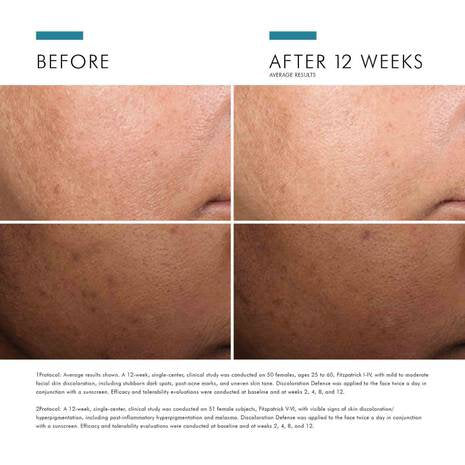 SkinCeuticals - Discoloration Defense