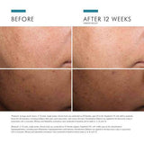 SkinCeuticals - Discoloration Defense
