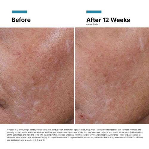 SkinCeuticals - Hyaluronic Acid (HA) Intensifier Multi-Glycan