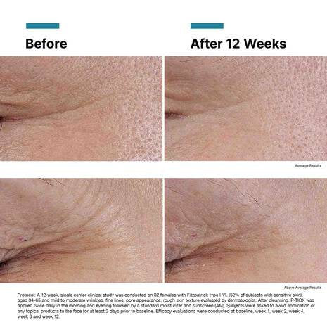 SkinCeuticals - P-TIOX