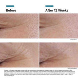 SkinCeuticals - P-TIOX