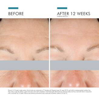 SkinCeuticals - A.G.E. Eye Advanced