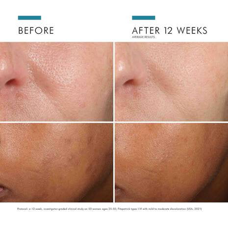 SkinCeuticals - Phloretin CF