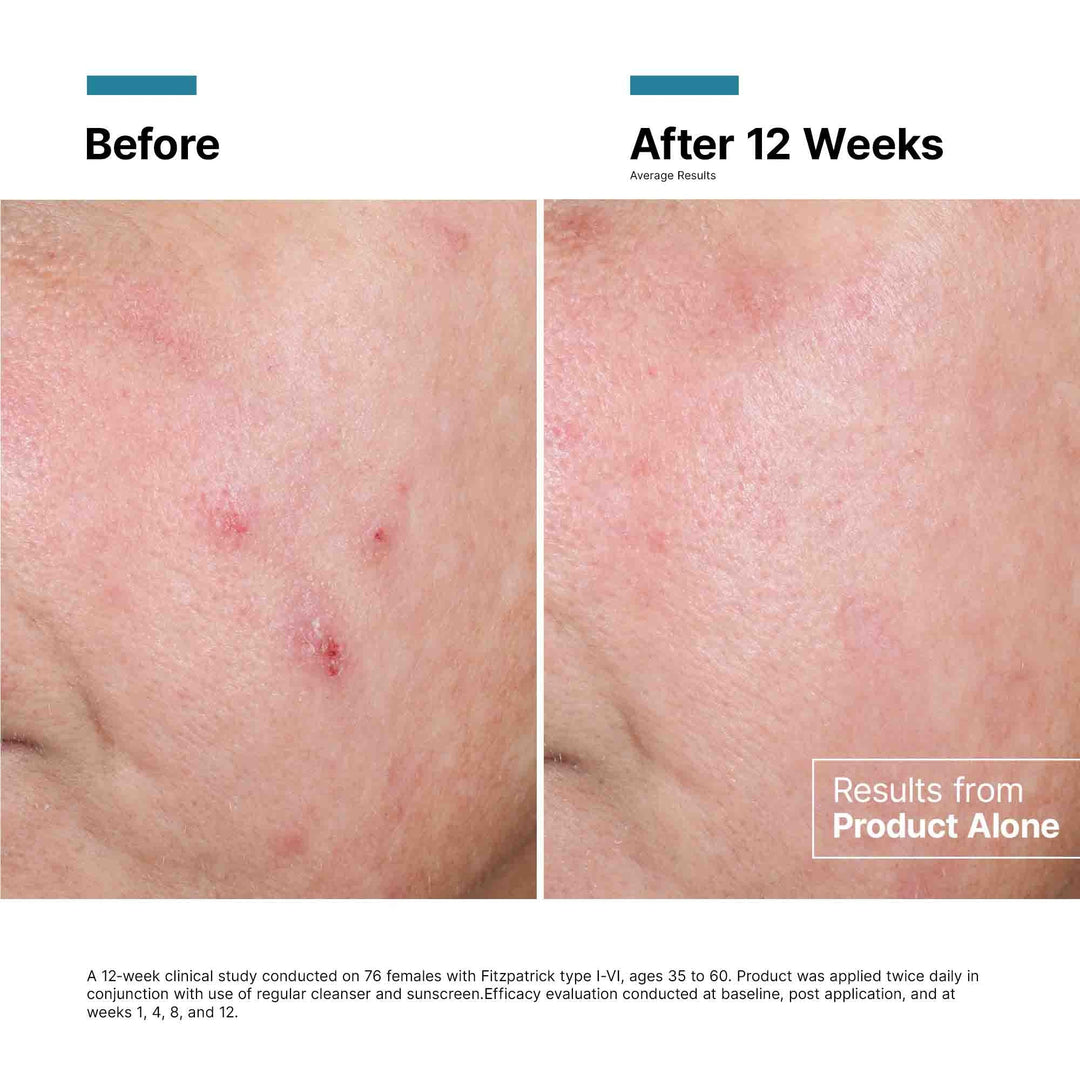 SkinCeuticals - Advanced RGN-6