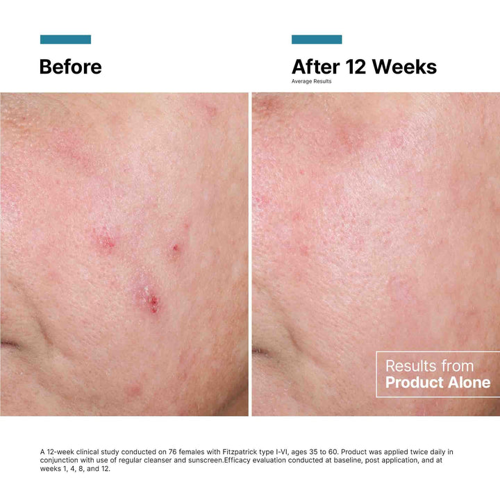SkinCeuticals - Advanced RGN-6