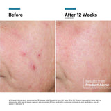 SkinCeuticals - Advanced RGN-6