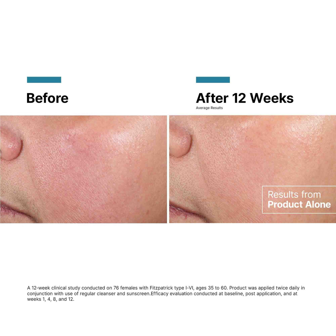 SkinCeuticals - Advanced RGN-6