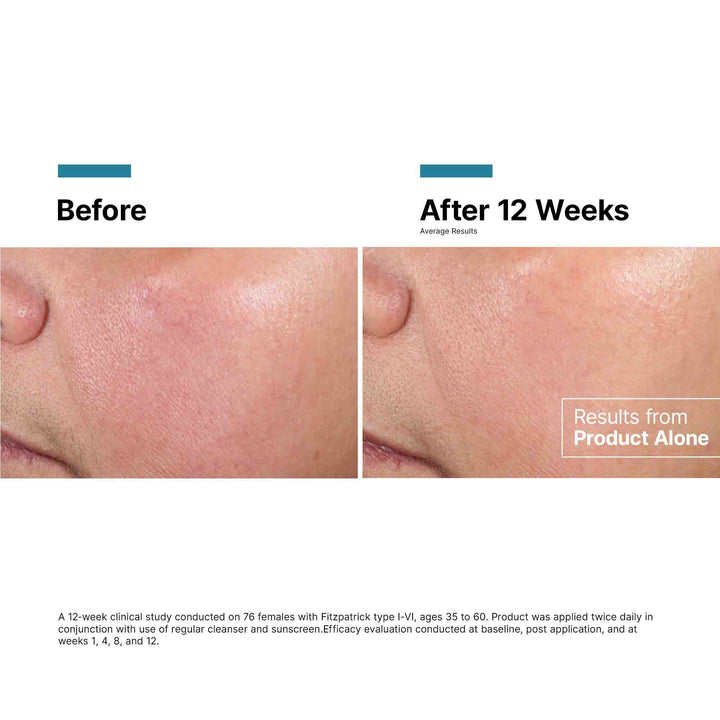 SkinCeuticals - Advanced RGN-6