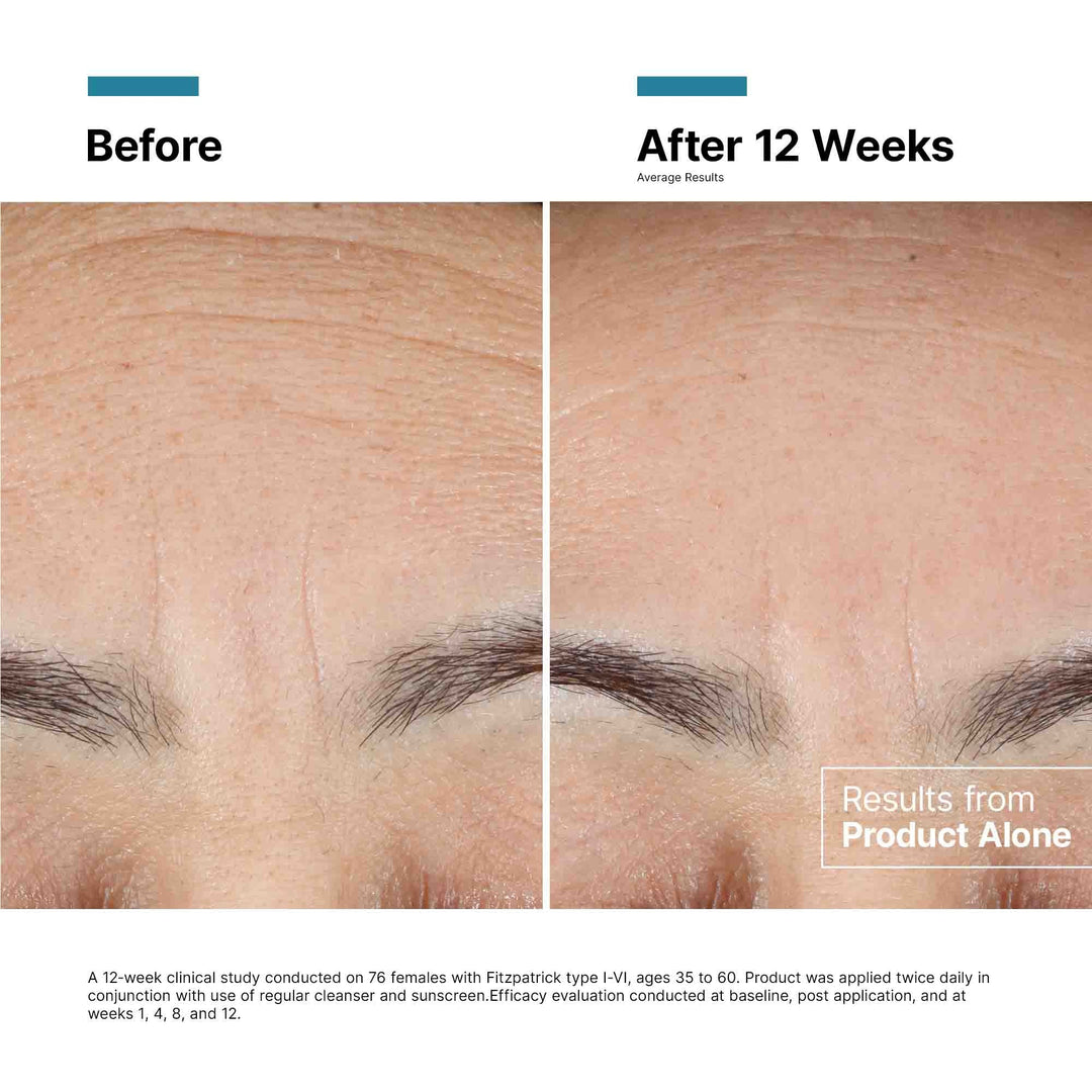 SkinCeuticals - Advanced RGN-6
