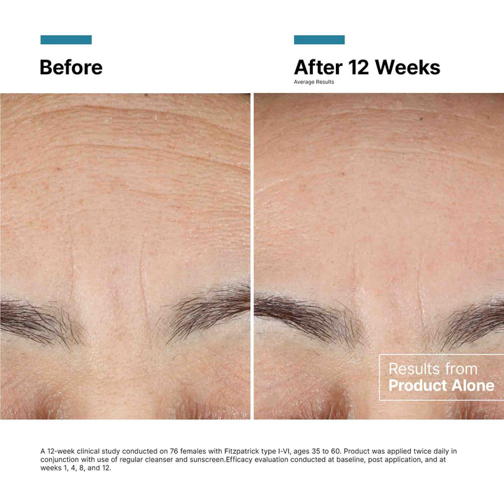 SkinCeuticals - Advanced RGN-6