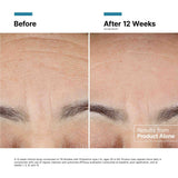 SkinCeuticals - Advanced RGN-6