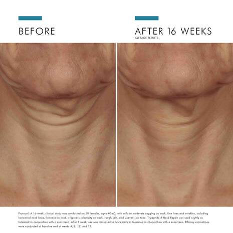 SkinCeuticals - Tripeptide-R Neck Repair