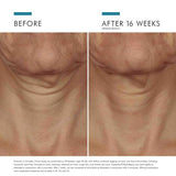 SkinCeuticals - Tripeptide-R Neck Repair