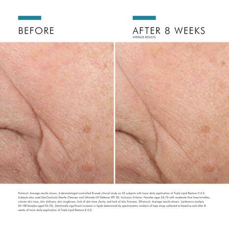 SkinCeuticals - Triple Lipid Restore 2:4:2