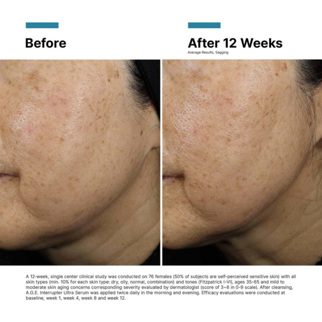 SkinCeuticals - A.G.E. Interrupter Ultra Serum