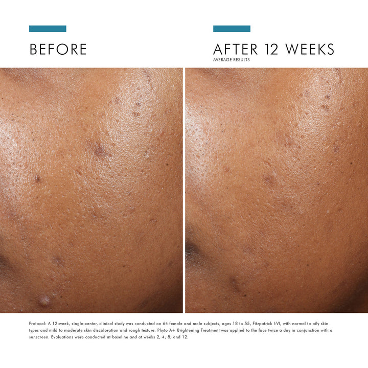 SkinCeuticals - Phyto A+ Brightening Treatment