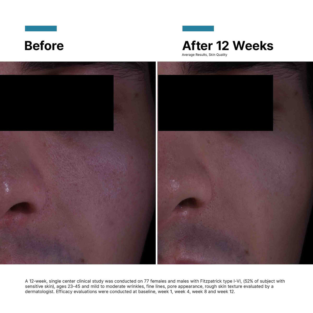 SkinCeuticals - P-TIOX Cream